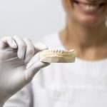 Имплантационная система Izen Implant: надёжное восстановление зубов по доступной цене